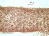 2 – Cellule corticali in visione superficiale